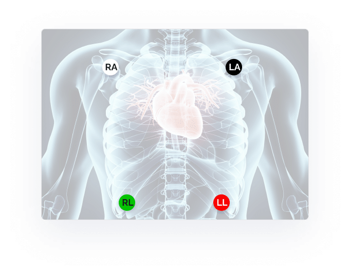 chest x-ray