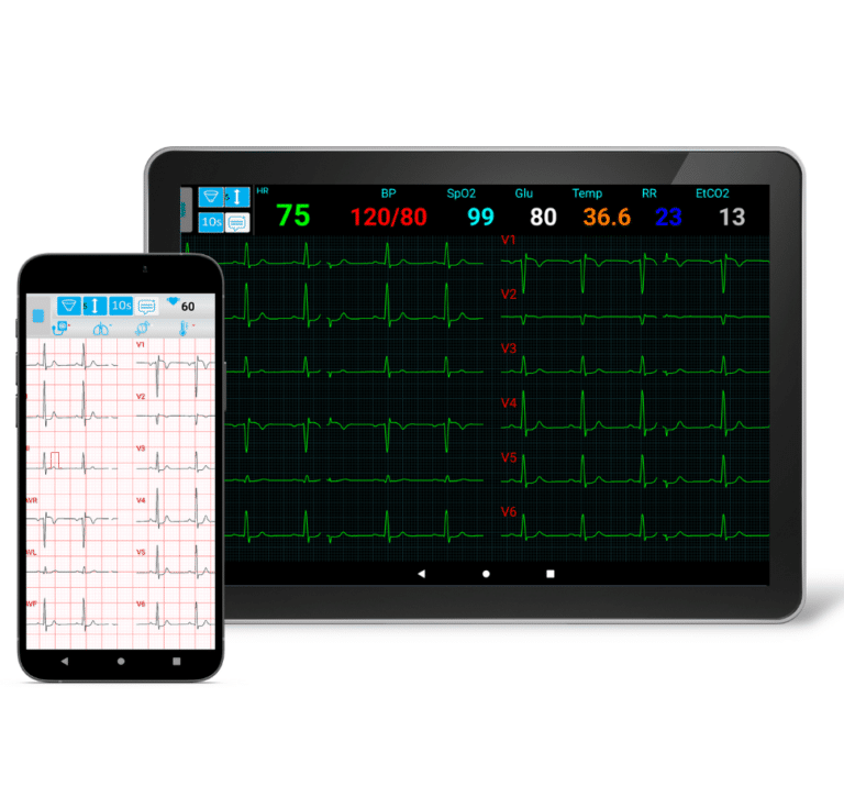 Telemetry ECG Systems for Cardiac Rehabilitation