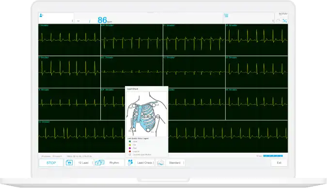 Resting / stress ECG workstation software