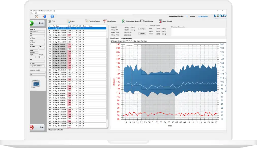 ABPM analysis and reporting