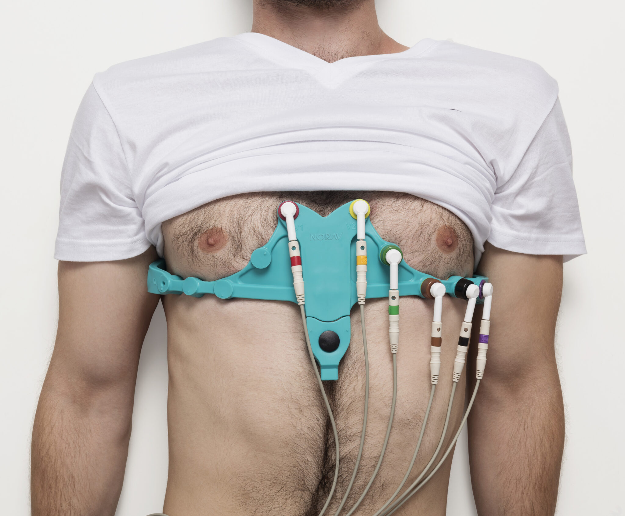 Telemetry ECG Systems for Cardiac Rehabilitation